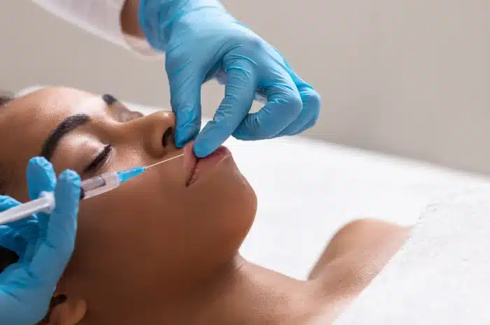 A person with closed eyes receives a facial injection in the upper lip area from a medical professional wearing blue gloves. The subject lies on their back with a white towel covering their chest. The scene appears to be in a clinical setting.
