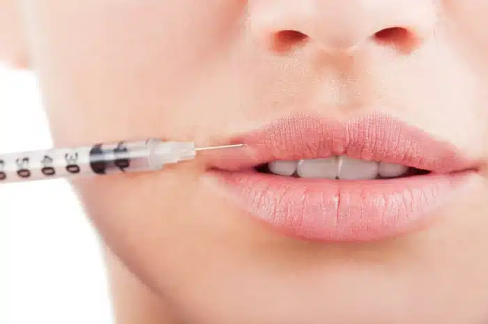 Close-up of a person receiving an injection in the upper lip. The syringe is positioned near the center of the lip, which is slightly parted. The image focuses on the lower half of the face, highlighting the lips and the needle.