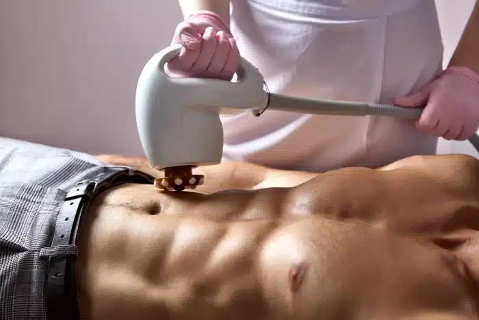 A person is undergoing a body contouring or skin tightening procedure on their abdominal area. Another individual, wearing gloves, is holding and using a medical device emitting radiofrequency or ultrasound waves on the stomach.