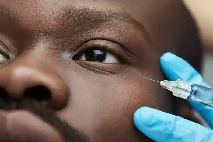 Close-up of a person receiving an injection near their eye. A hand wearing blue medical gloves is holding a syringe with the needle about to make contact with the skin. The focus is on the area around the eye and the syringe.