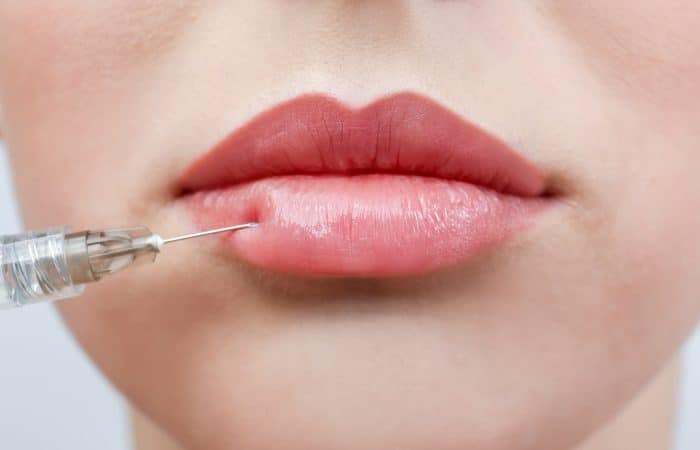 Close-up of a person’s lips receiving non-invasive lip fillers with a needle near the lower lip. The background is plain, focusing on the mouth and the syringe.