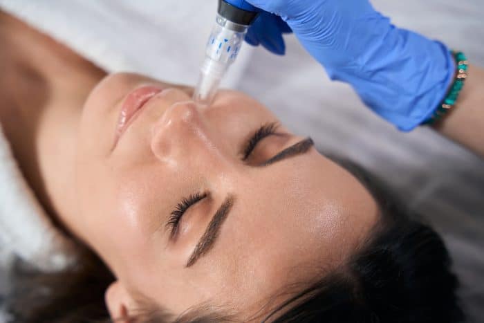 A person with closed eyes is receiving a facial treatment. A gloved hand is holding a dermapen and applying it to the person's nose. The person appears relaxed, lying down, and has clear, smooth skin, possibly preparing for an LED session after microneedling.