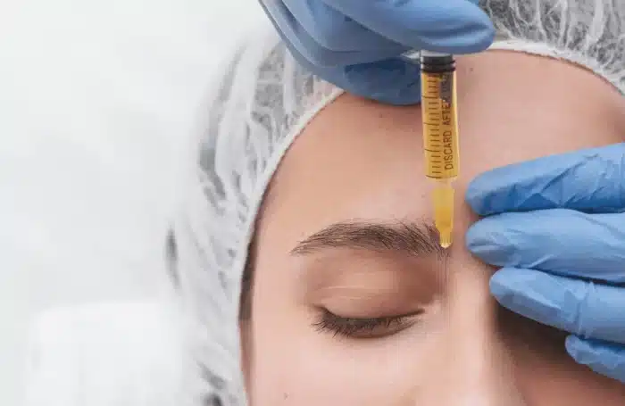A person with a hair cap and eyes closed is receiving an injection in the forehead from a medical professional wearing blue gloves, likely for mesotherapy. The syringe contains a yellowish fluid.