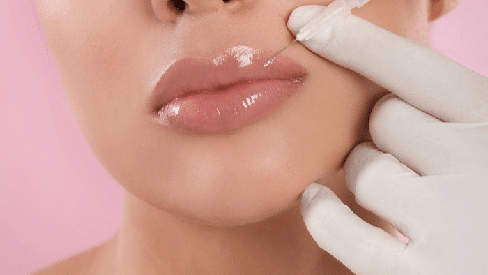 Close-up of a person's face receiving a cosmetic lip filler injection. A gloved hand holds a syringe close to their lips, suggesting a procedure to enhance or augment the lips with Filorga. The background is a soft pink.