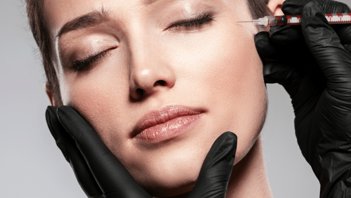 A close-up of a person with closed eyes receiving a Profhilo injection near their temple. They have a calm expression, and the procedure is being conducted by a professional wearing black gloves. The image highlights the person's smooth skin and the syringe in the professional's hand.
