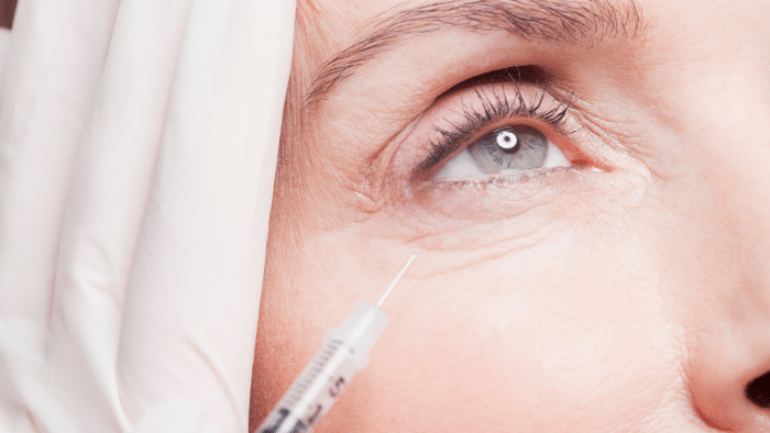 Close-up of a person’s face receiving an injection near the eye. The person’s eye is open with a neutral expression. A gloved hand holds the syringe, which is positioned underneath the eye. The skin shows natural wrinkles and fine lines, illustrating how Botox was discovered to smooth such features.