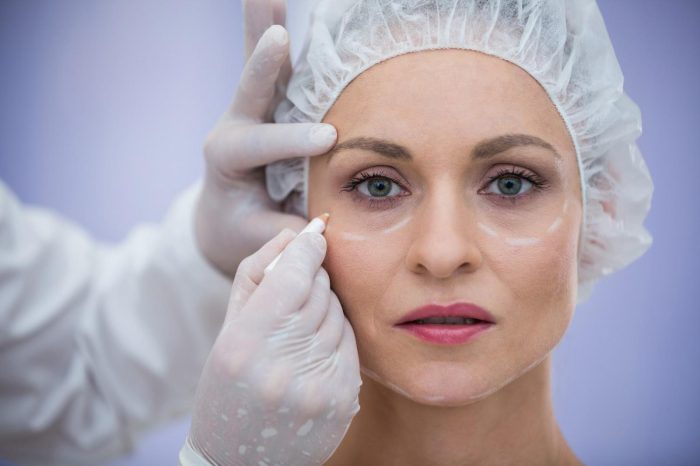 A woman wearing a hairnet and looking forward with a neutral expression. A person, whose hands are gloved, is marking the woman's face with a white pencil, indicating spots under her eyes and beside her nose for dysport treatment of under eye wrinkles. The background is a soft, blurred light purple.