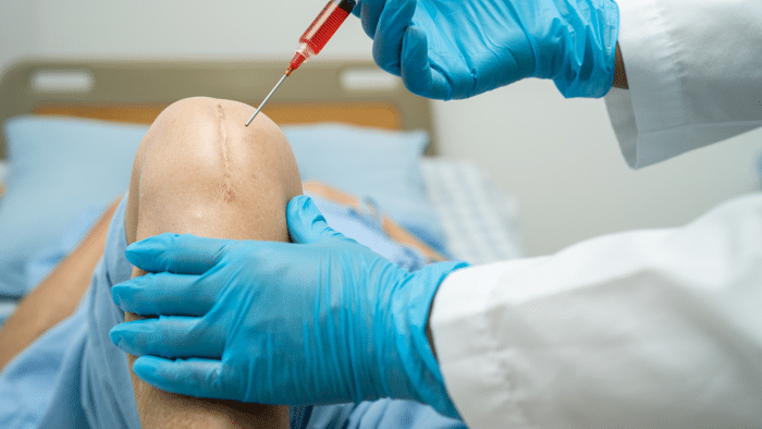 A person with a visible scar on their knee lies on a hospital bed. A healthcare professional wearing blue gloves is injecting a syringe into the knee, possibly administering Orthovisc or Synvisc. The background shows bedding and a headboard, indicating a clinical setting.
