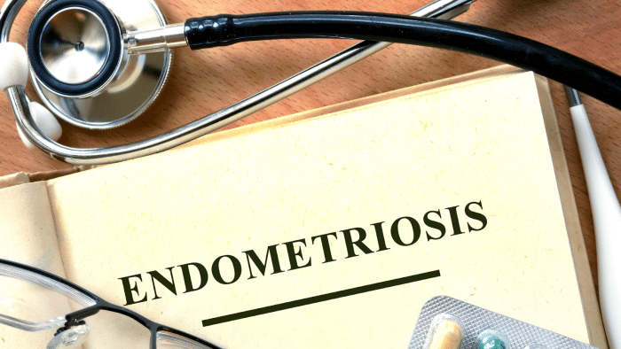 An open book showing the word "ENDOMETRIOSIS" in bold letters, with a stethoscope draped over it. Nearby are a pair of glasses and a blister pack of pills, all placed on a wooden surface.