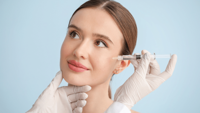 Teosyal filler treatment.