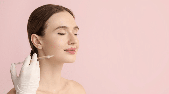 Teosyal filler treatment.