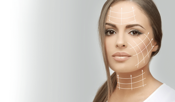 A woman with light skin and long, straight hair pulled over one shoulder is shown against a light grey background. She has facial contour lines drawn on her forehead, cheeks, and jawline, indicating areas for cosmetic treatment or facial mapping.