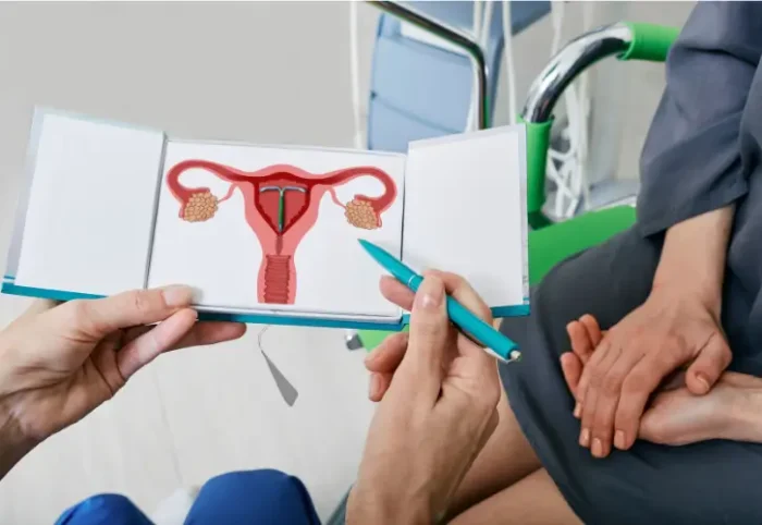 Mirena IUD for endometriosis