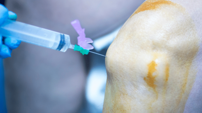 A healthcare professional wearing blue gloves administers an injection into a person's knee. The skin is prepared with an antiseptic, appearing slightly orange. The needle is connected to a syringe with a pink and green attachment.