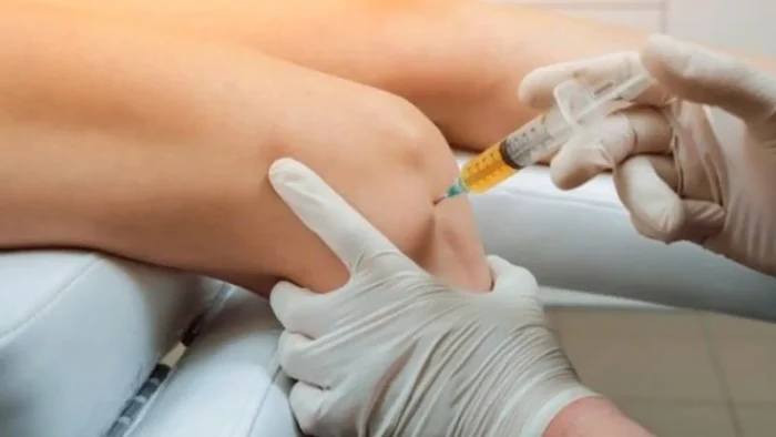 A person wearing gloves is injecting a syringe into a patient's knee while both are on a medical examination table. The yellowish liquid in the syringe suggests a medical procedure, possibly for pain relief or treatment.