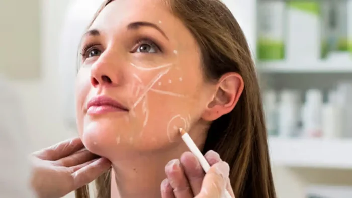 A woman with surgical markings on her face is being examined by gloved hands in a clinical setting, suggesting a cosmetic procedure. Shelves with bottles are blurred in the background.