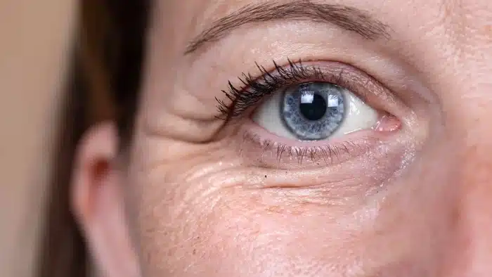 Close-up of a person's eye, showing blue iris and detailed skin texture, including fine lines and wrinkles. The eyelashes are coated with mascara, and the lighting highlights the eye and skin features.