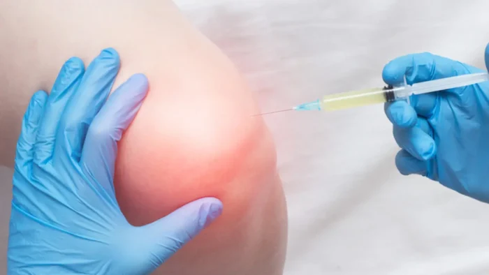 A close-up of a medical professional wearing blue gloves injecting a syringe into a patient's knee. The knee appears slightly reddened, suggesting inflammation or treatment for joint pain.