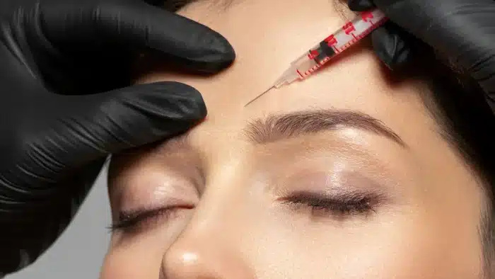 Close-up of a person receiving a cosmetic injection in the forehead. They have closed eyes, and the procedure is being done by hands in black gloves using a syringe. The focus is on the forehead and brow area.