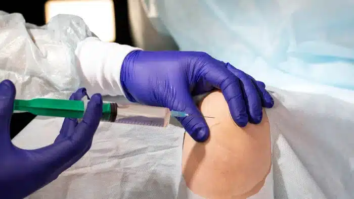 A person wearing purple gloves is administering a syringe injection into a patient's knee. The patient is lying on a medical table, partially covered with a blue drape.