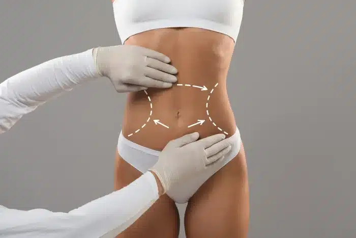 A person in white underwear with gloved hands examining their waist, showing dashed lines and arrows around the abdomen on a gray background.