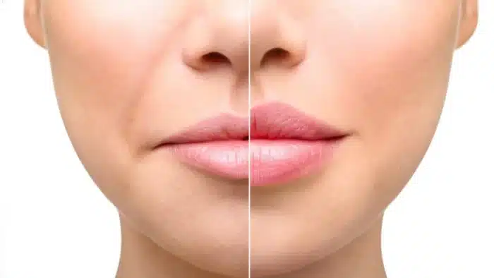 Lip differences.