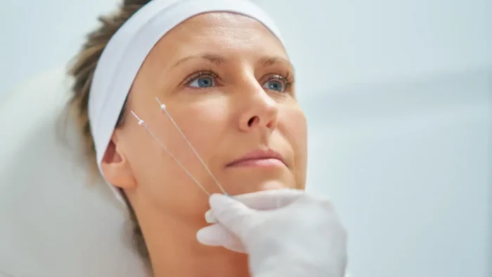 Woman's face getting threaded.