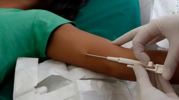 A person lying down receives a contraceptive implant in their upper arm. A healthcare professional wearing gloves uses a specialized applicator for the procedure. The person's arm rests on a white cloth.