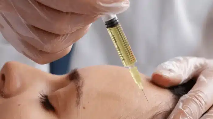 A close-up of a person receiving a facial injection. A gloved hand holds a syringe filled with a yellowish liquid, targeting the person's forehead. The person’s eyes are closed, suggesting a calm or relaxed demeanor.