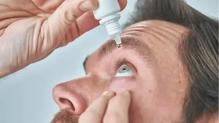 Close-up of a person tilting their head back, using their fingers to hold an eyelid open while administering eye drops with a dropper. The focus is on the drop about to enter the eye.