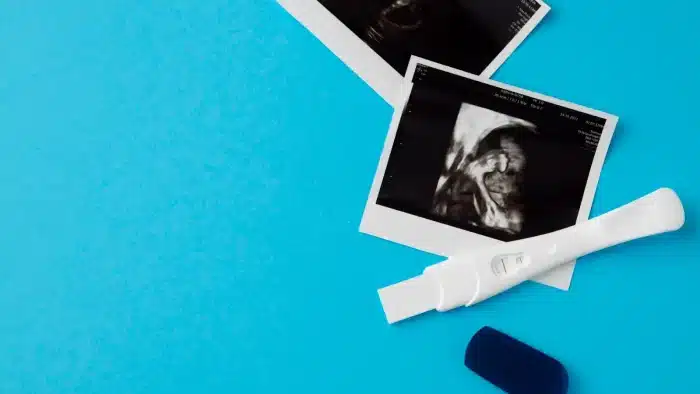 A pregnancy test and two ultrasound images rest on a bright blue background. The test shows a positive result, and the ultrasounds display fetal images. An open blue cap is nearby.
