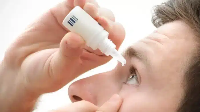 A person is tilting their head back and using a small bottle to administer eye drops into their right eye. The image focuses on the act of applying the drops, with the bottle close to the eye.