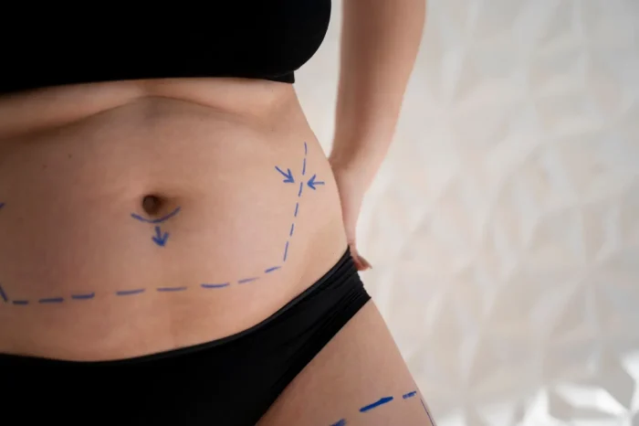 Stomach incision marks.