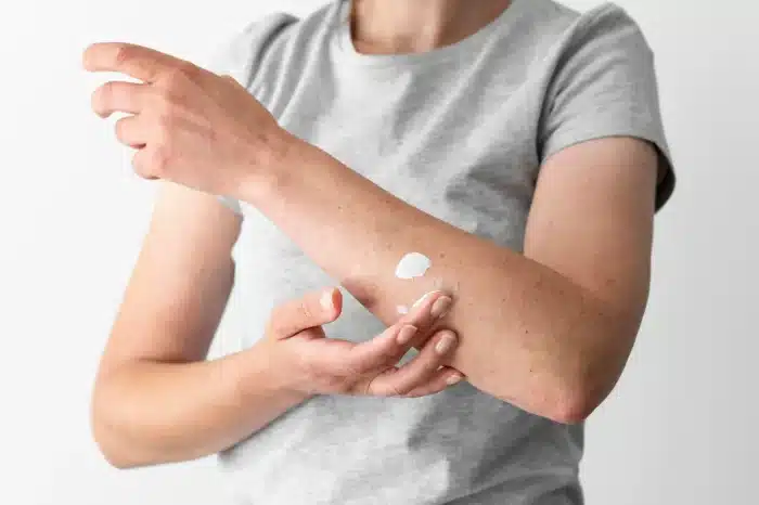 A person wearing a gray t-shirt applies lotion to their forearm. The image focuses on their hands and arms against a plain white background.