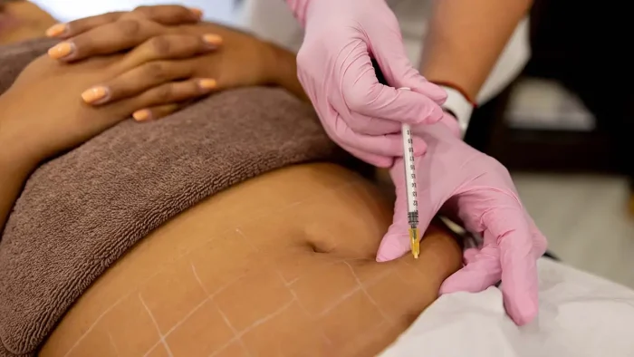 A person wearing pink gloves injects a syringe into the abdomen of another person, whose midsection is marked with white grid lines. The patient is lying down with hands folded over a brown towel.
